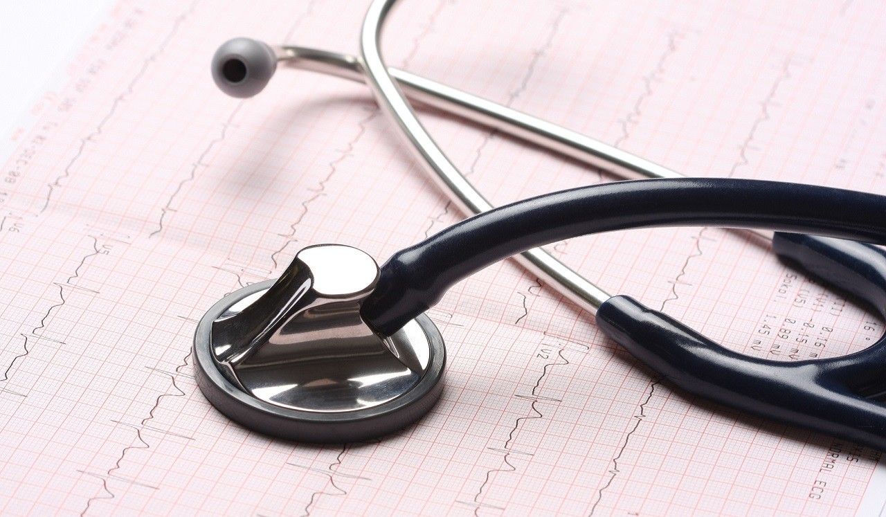 A stethoscope placed on printed heart-rate graphs.