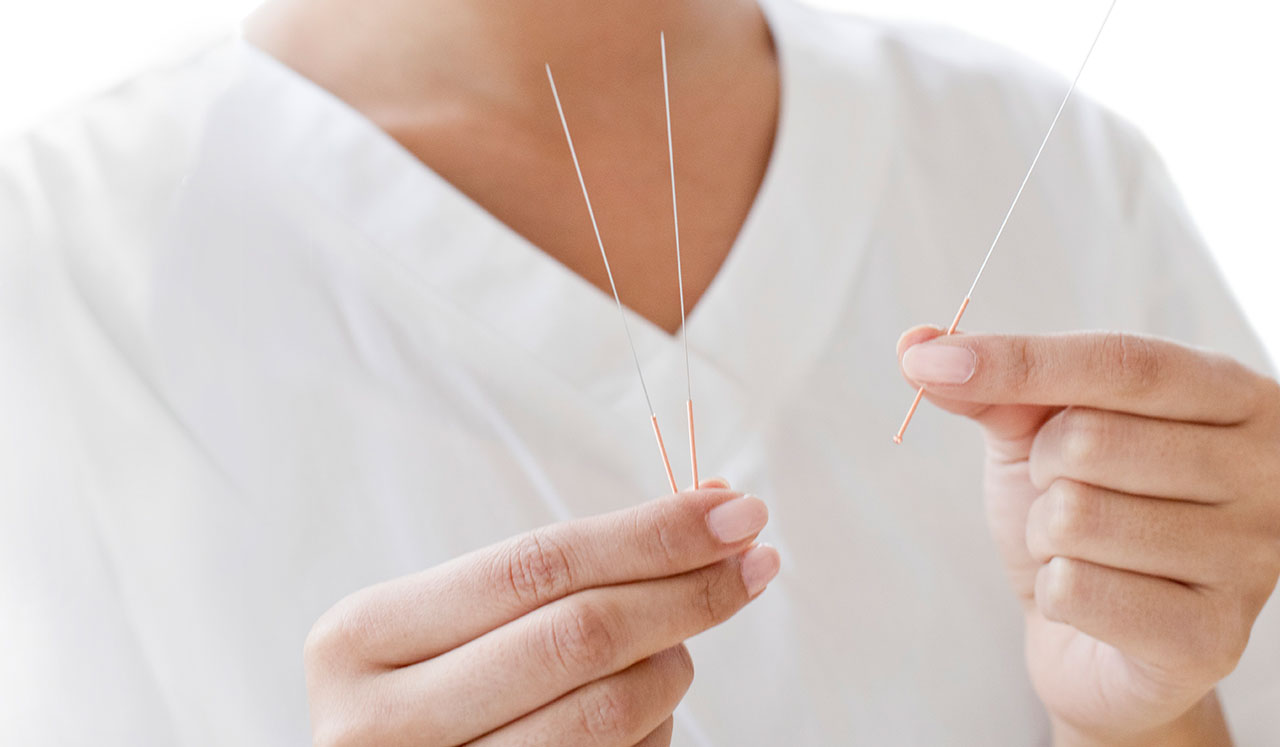 A woman holding acupuncture needles.